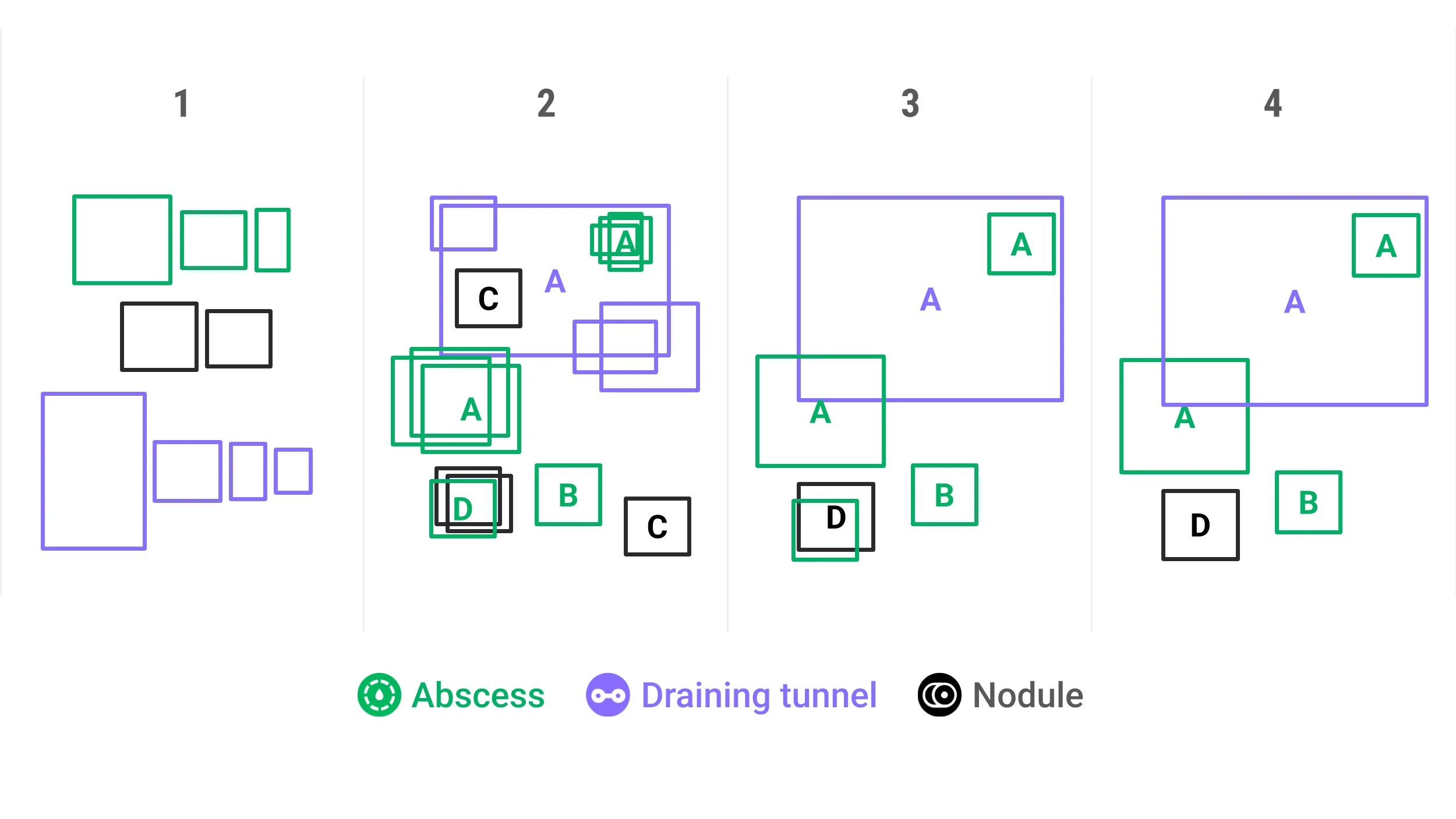 Automatic International Hidradenitis Suppurativa Severity Score System (AIHS4)