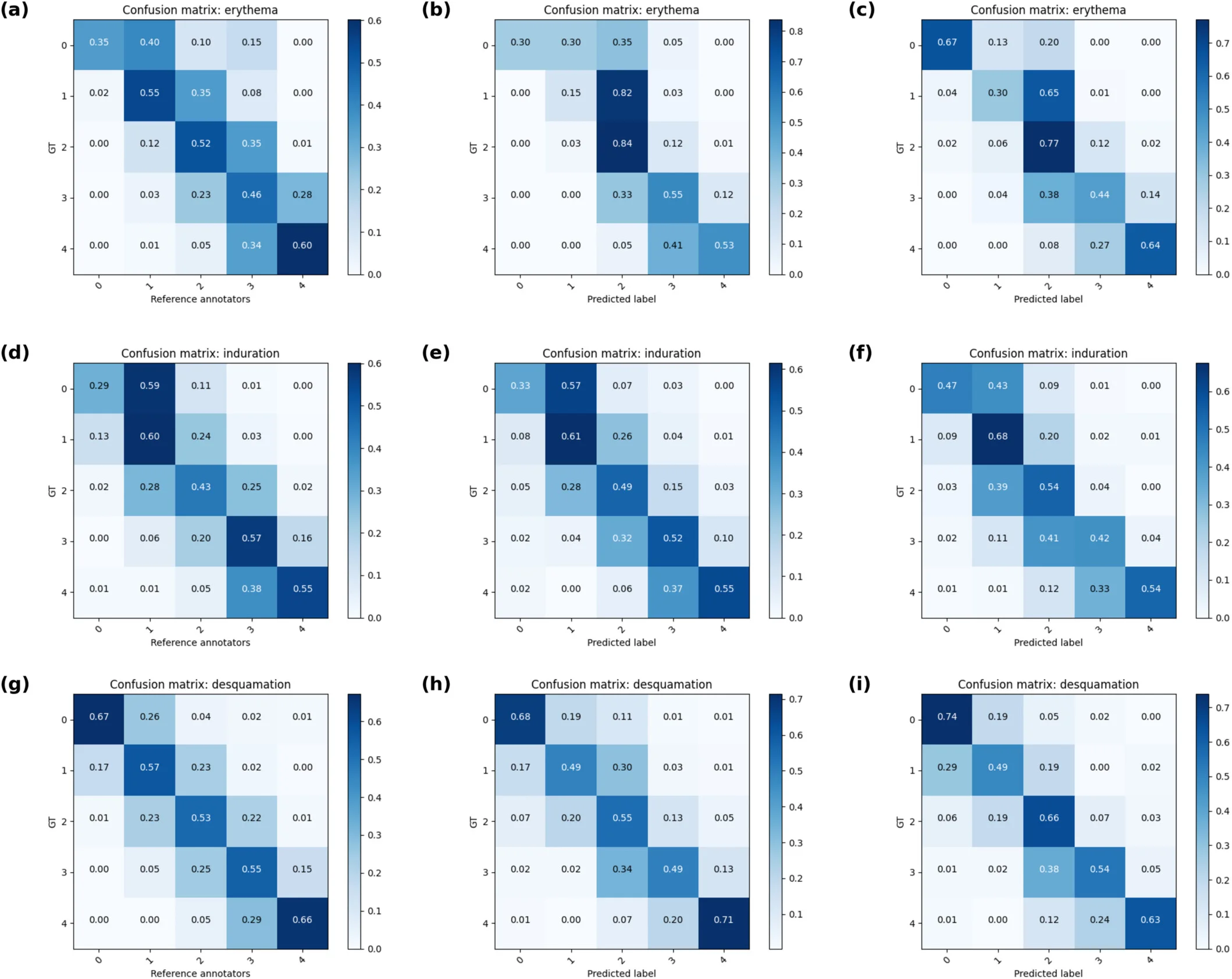 Automatic Psoriasis Area and Severity Index (APASI)